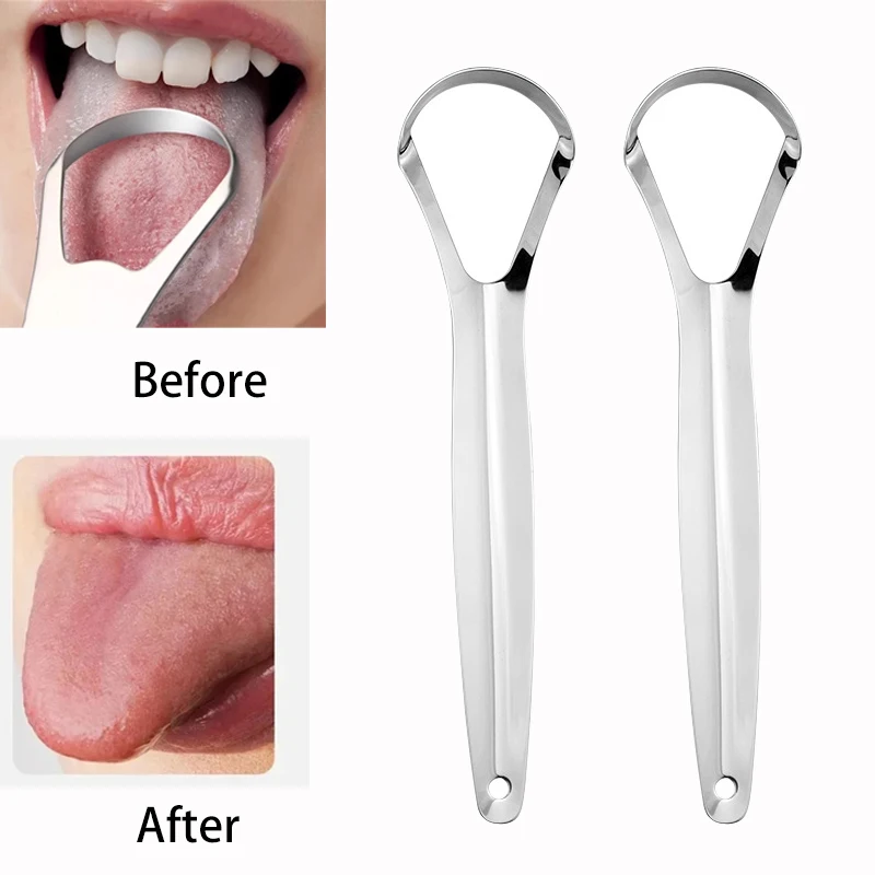 Tongue Scraper Metal - Halitose Tong Coating Tongschraper Roestvrij Staal