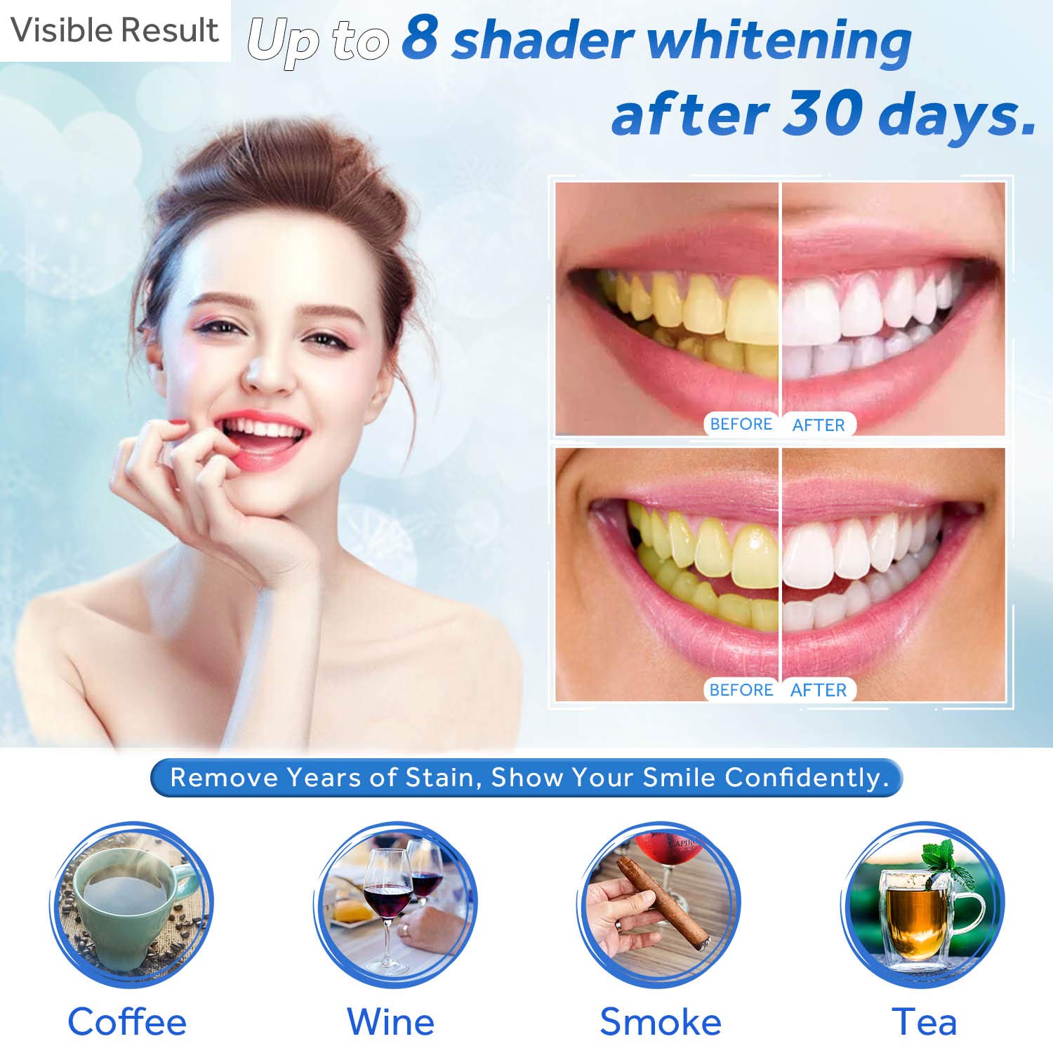 Tanden Whitening Gel Refill Sp - Teeth Whitening Diy recensie en prijs
