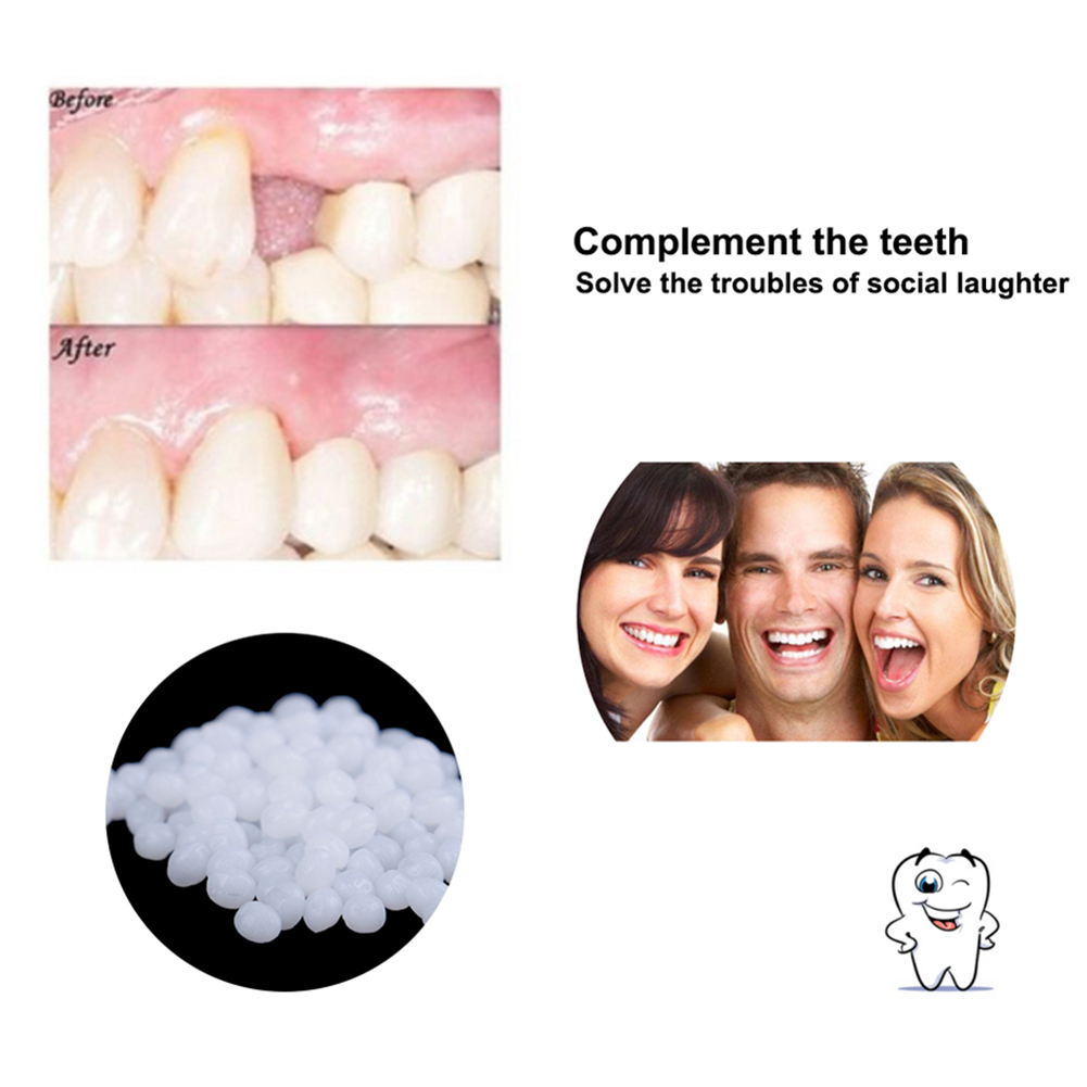 10/100g DIY Kunstgebitten Bijt - Teeth Whitening Diy recensie en prijs