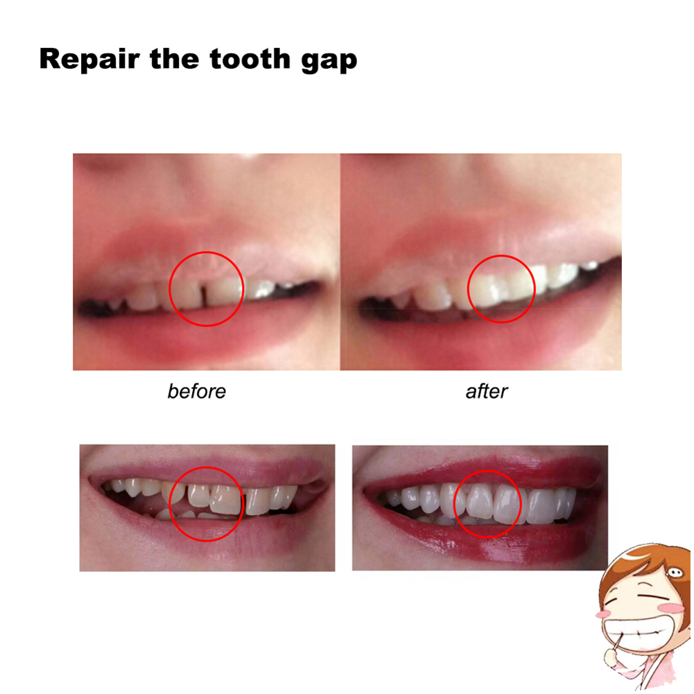 10/100g DIY Kunstgebitten Bijt - Teeth Whitening Diy recensie en prijs