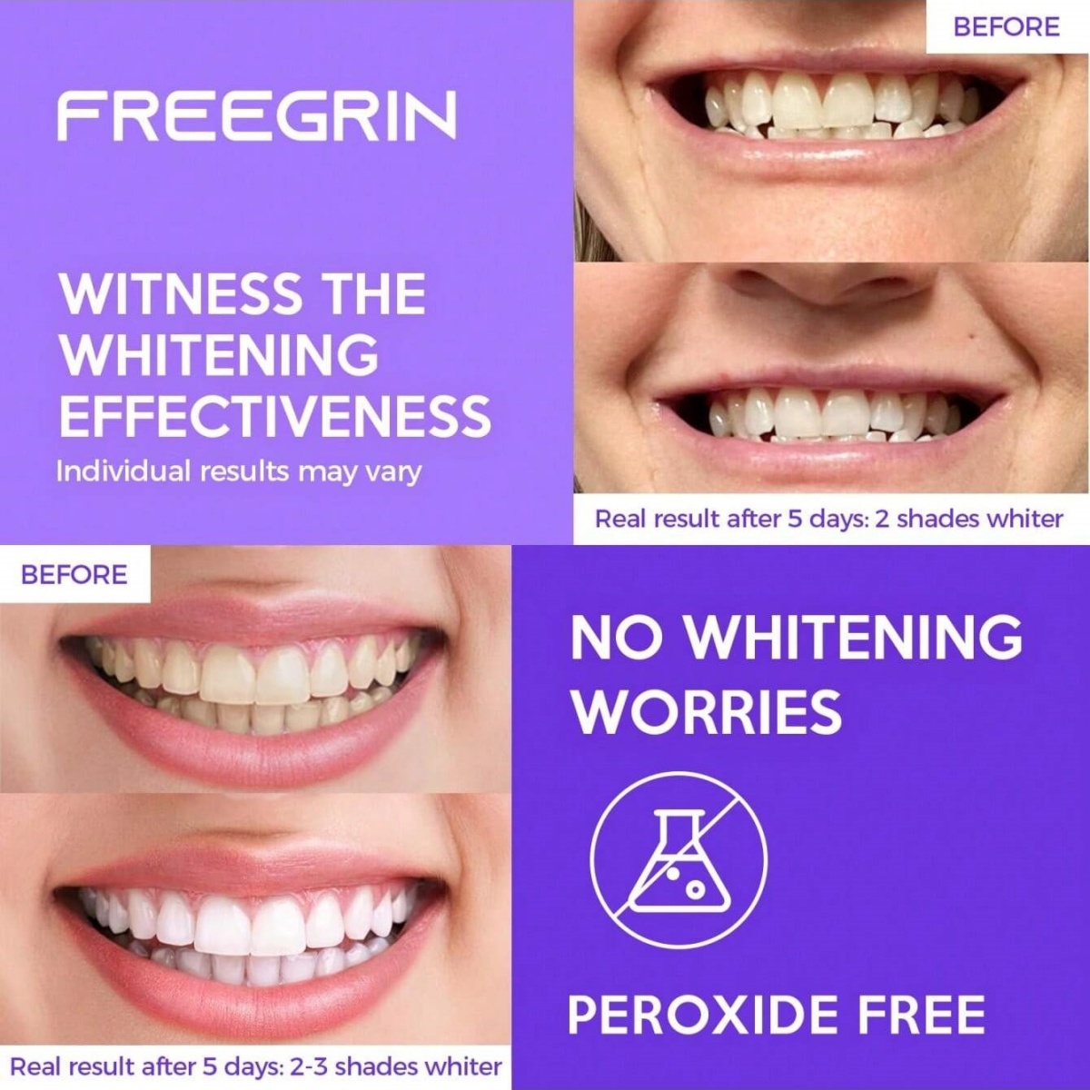 Deluxe Tanden Whitening Sticke - Teeth Whitening Groupon recensie en prijs