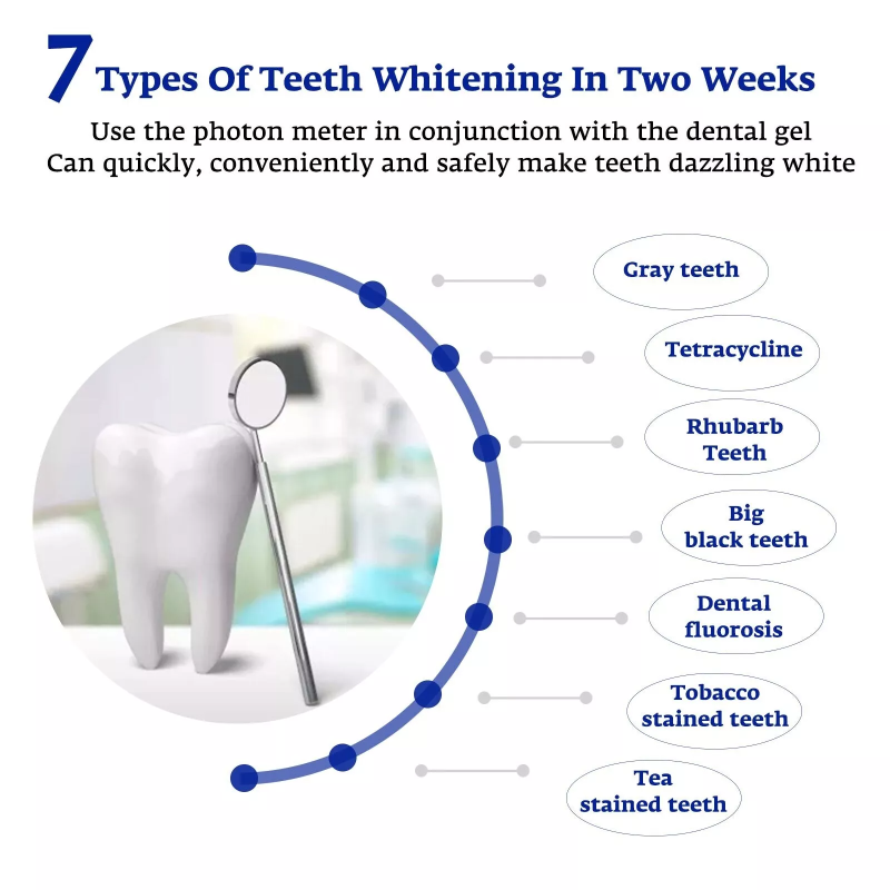 Tanden Whitening Accelerator S - Teeth Whitening Uv recensie en prijs