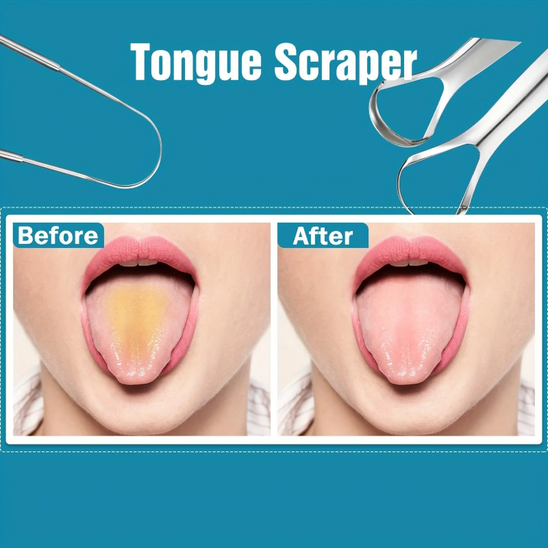 Tongschraper van roestvrij sta - Tongue Scraper Metal recensie en prijs